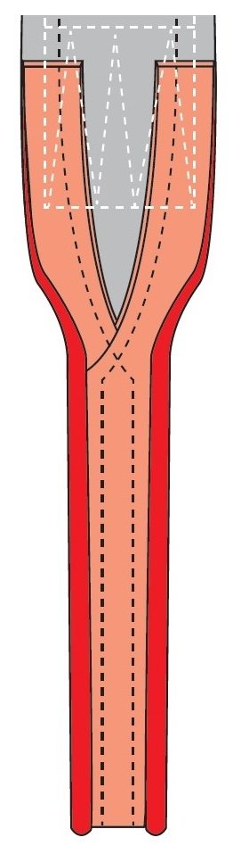 AVANTAJE SPANSET 26.jpg